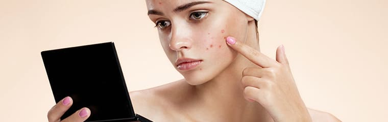 femme probleme acne fond beige